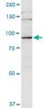 PiggyBac Transposable Element Derived 1 antibody, H00084547-M05, Novus Biologicals, Western Blot image 
