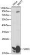 Superoxide Dismutase 1 antibody, 13-120, ProSci, Western Blot image 