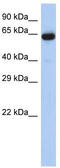 Leucine Rich Repeat Transmembrane Neuronal 1 antibody, TA333418, Origene, Western Blot image 