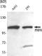 PHD Finger Protein 8 antibody, A03288, Boster Biological Technology, Western Blot image 