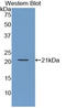 Actin Related Protein 2/3 Complex Subunit 4 antibody, LS-C292608, Lifespan Biosciences, Western Blot image 