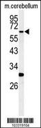 Receptor Interacting Serine/Threonine Kinase 3 antibody, 63-216, ProSci, Western Blot image 