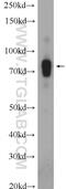 ADAM Metallopeptidase Domain 19 antibody, 22216-1-AP, Proteintech Group, Western Blot image 