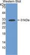 Fms Related Tyrosine Kinase 1 antibody, LS-C296964, Lifespan Biosciences, Western Blot image 