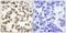 BRCA1 DNA Repair Associated antibody, GTX50557, GeneTex, Immunohistochemistry paraffin image 