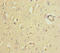 Golgi Reassembly Stacking Protein 2 antibody, LS-C675824, Lifespan Biosciences, Immunohistochemistry paraffin image 