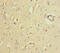 Golgi reassembly-stacking protein 2 antibody, LS-C675824, Lifespan Biosciences, Immunohistochemistry paraffin image 