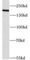 Lysine Demethylase 3B antibody, FNab04511, FineTest, Western Blot image 