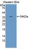 Endoplasmic Reticulum Aminopeptidase 2 antibody, LS-C695765, Lifespan Biosciences, Western Blot image 