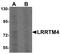 Leucine-rich repeat transmembrane neuronal protein 4 antibody, A13110, Boster Biological Technology, Western Blot image 