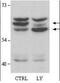 Glutathione S-transferase class-mu 26 kDa isozyme antibody, orb345285, Biorbyt, Western Blot image 