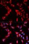 Eukaryotic Translation Initiation Factor 4B antibody, LS-C748357, Lifespan Biosciences, Immunofluorescence image 
