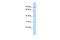 TCDD Inducible Poly(ADP-Ribose) Polymerase antibody, PA5-40774, Invitrogen Antibodies, Western Blot image 