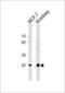Carbonic Anhydrase 2 antibody, 62-808, ProSci, Western Blot image 