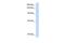 Minichromosome Maintenance 8 Homologous Recombination Repair Factor antibody, PA5-41325, Invitrogen Antibodies, Western Blot image 