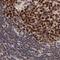 Telomeric Repeat Binding Factor 2 antibody, NBP1-86910, Novus Biologicals, Immunohistochemistry paraffin image 