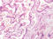 Aggrecan antibody, LS-A1561, Lifespan Biosciences, Immunohistochemistry paraffin image 