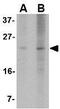 BCL2 Binding Component 3 antibody, GTX84992, GeneTex, Western Blot image 