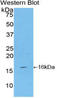 CD70 Molecule antibody, LS-C296873, Lifespan Biosciences, Western Blot image 