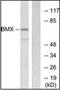 BMX Non-Receptor Tyrosine Kinase antibody, orb94868, Biorbyt, Western Blot image 