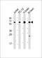 Calcium/Calmodulin Dependent Protein Kinase II Beta antibody, M03964-1, Boster Biological Technology, Western Blot image 