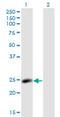 Lysophospholipase 2 antibody, H00011313-M01, Novus Biologicals, Western Blot image 