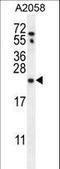 RAB10, Member RAS Oncogene Family antibody, LS-C162354, Lifespan Biosciences, Western Blot image 