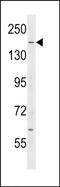 Ras GTPase-activating-like protein IQGAP2 antibody, PA5-49052, Invitrogen Antibodies, Western Blot image 