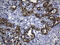 Glutamyl-TRNA Synthetase 2, Mitochondrial antibody, M08567, Boster Biological Technology, Immunohistochemistry paraffin image 