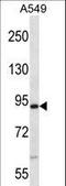 NIMA Related Kinase 4 antibody, LS-C164496, Lifespan Biosciences, Western Blot image 