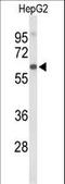 Afamin antibody, LS-C156134, Lifespan Biosciences, Western Blot image 