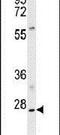 Apolipoprotein B MRNA Editing Enzyme Catalytic Subunit 3A antibody, PA5-11431, Invitrogen Antibodies, Western Blot image 