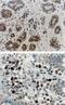 Receptor-interacting serine/threonine-protein kinase 1 antibody, NB100-56160, Novus Biologicals, Immunohistochemistry frozen image 