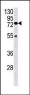 Hexosaminidase Subunit Alpha antibody, ab91624, Abcam, Western Blot image 