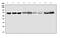 Interferon Alpha And Beta Receptor Subunit 1 antibody, A00306-2, Boster Biological Technology, Western Blot image 