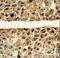 Arginase 1 antibody, LS-C156458, Lifespan Biosciences, Immunohistochemistry paraffin image 