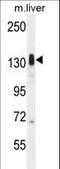 Lemur Tyrosine Kinase 3 antibody, LS-C165815, Lifespan Biosciences, Western Blot image 