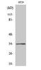 N-arachidonyl glycine receptor antibody, STJ93369, St John