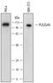 Phospholipase A2 Group IVA antibody, AF6659, R&D Systems, Western Blot image 