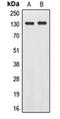 EPH Receptor A2 antibody, orb213884, Biorbyt, Western Blot image 