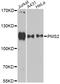 PMS1 Homolog 2, Mismatch Repair System Component antibody, A13680, ABclonal Technology, Western Blot image 