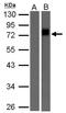 Biotin antibody, NBP2-15589, Novus Biologicals, Western Blot image 