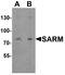 Sterile Alpha And TIR Motif Containing 1 antibody, A03633-1, Boster Biological Technology, Western Blot image 