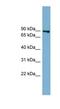 FAST Kinase Domains 2 antibody, NBP1-55360, Novus Biologicals, Western Blot image 