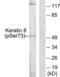 Keratin 8 antibody, LS-C199164, Lifespan Biosciences, Western Blot image 