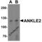 Kiaa0692 antibody, 6609, ProSci, Western Blot image 