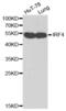 Interferon Regulatory Factor 4 antibody, abx000976, Abbexa, Western Blot image 