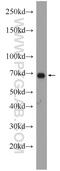 Propionyl-CoA Carboxylase Subunit Alpha antibody, 21988-1-AP, Proteintech Group, Western Blot image 