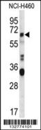 Endogenous Retrovirus Group FRD Member 1, Envelope antibody, 56-798, ProSci, Western Blot image 