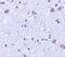 BR serine/threonine-protein kinase 1 antibody, GTX85054, GeneTex, Immunohistochemistry paraffin image 